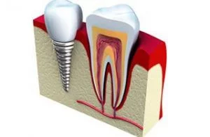 dental-help